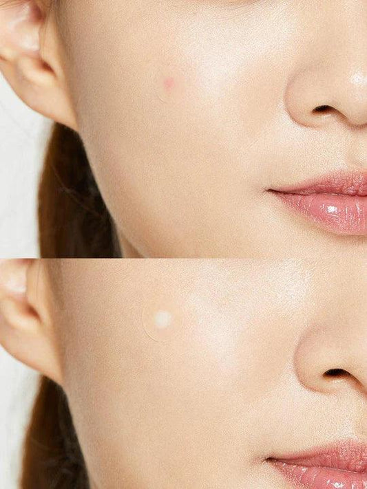 kbeauty skincare