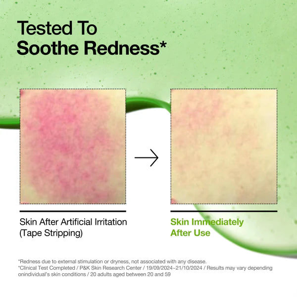 Anua - Azelaic Acid 10 Hyaluron Redness Soothing Serum