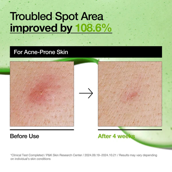 Anua - Azelaic Acid 10 Hyaluron Redness Soothing Serum
