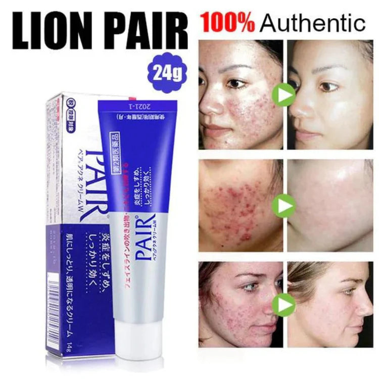 LION Pair Acne Cream W 24g