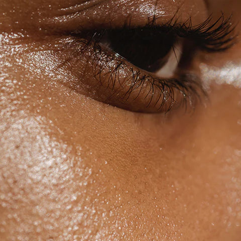 type de peau grasse, oily