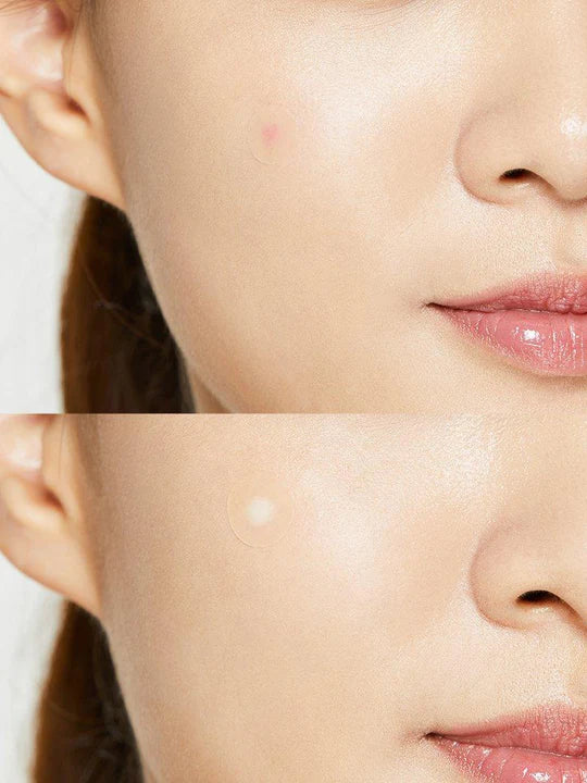 kbeauty skincare