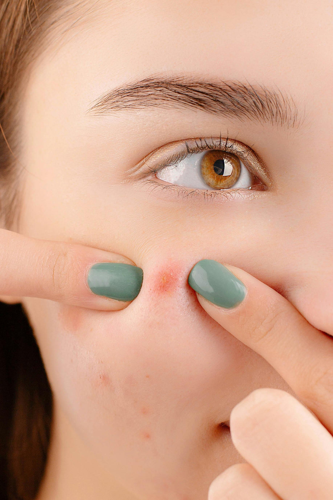Acné, boutons, points noir soins avec la skincare k-beauty