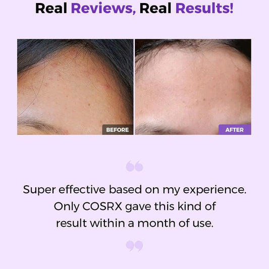 COSRX AHA/BHA Clarifying Treatment Toner 150ml - Coree Beauty