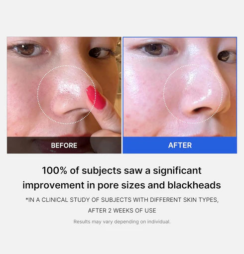 Medicube Zero pore pad 2.0 Coree Beauty
