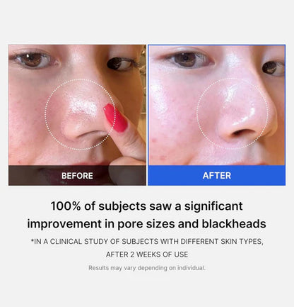 Medicube Zero pore pad 2.0 Coree Beauty