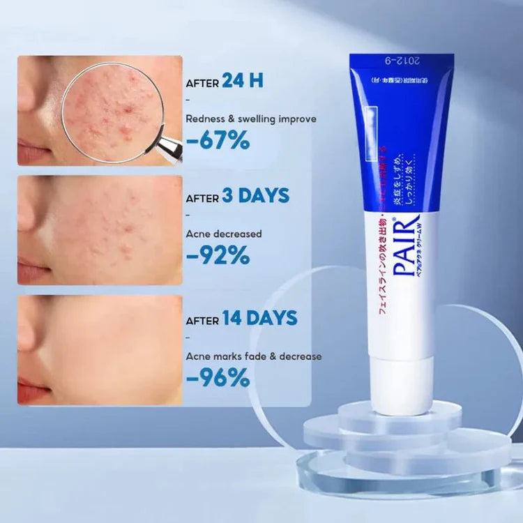 LION  Pair Acne Cream W 24g