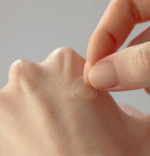 SOME BY MI 30 Days Miracle Clear Spot Patch